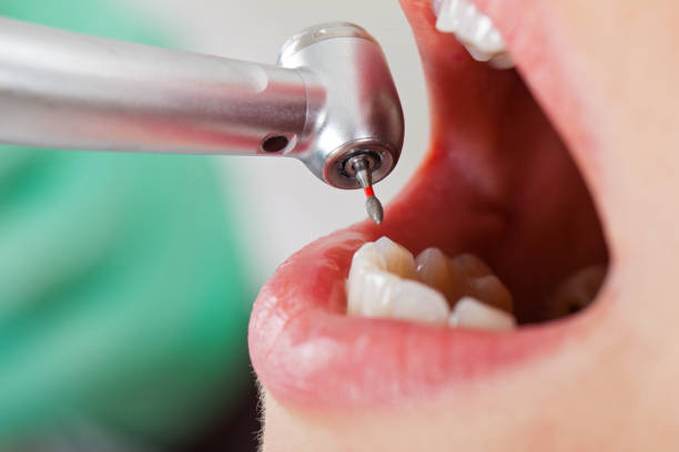Best Emergency Dental Services for Seniors in Georgetown, GA